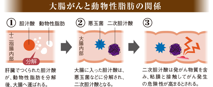 大腸がんと動物性脂肪の関係