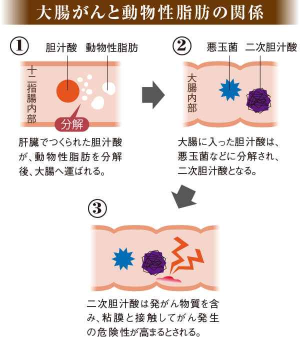 大腸がんと動物性脂肪の関係